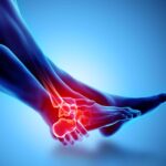 Διάστρεμμα της ποδοκνημικής Ankle painful – skeleton x-ray.